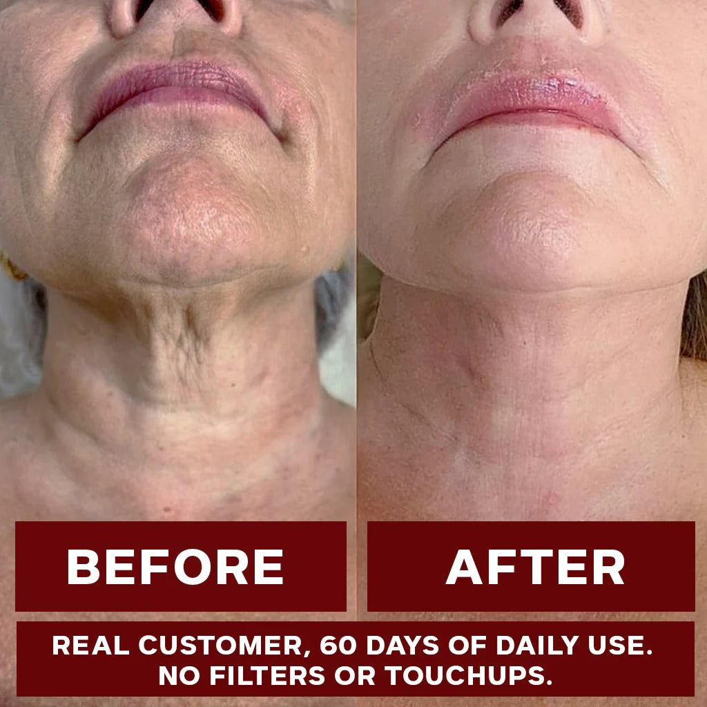 Anti-aging supplement (Nad+1000mg)