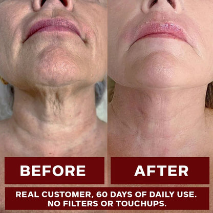 Anti-aging supplement (Nad+1000mg)